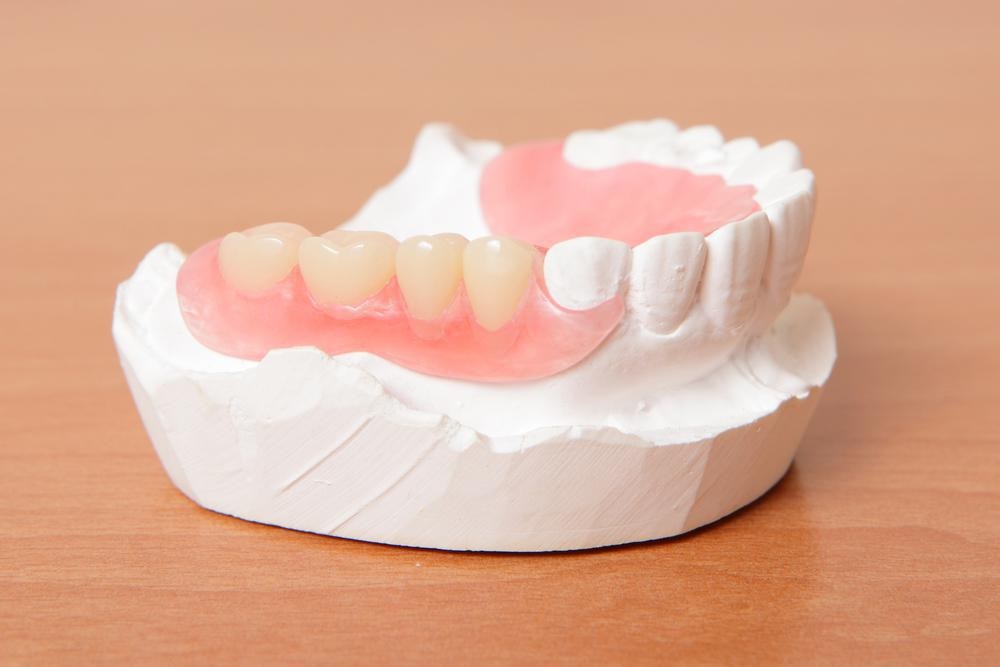 Types of Dentures You Could Choose From