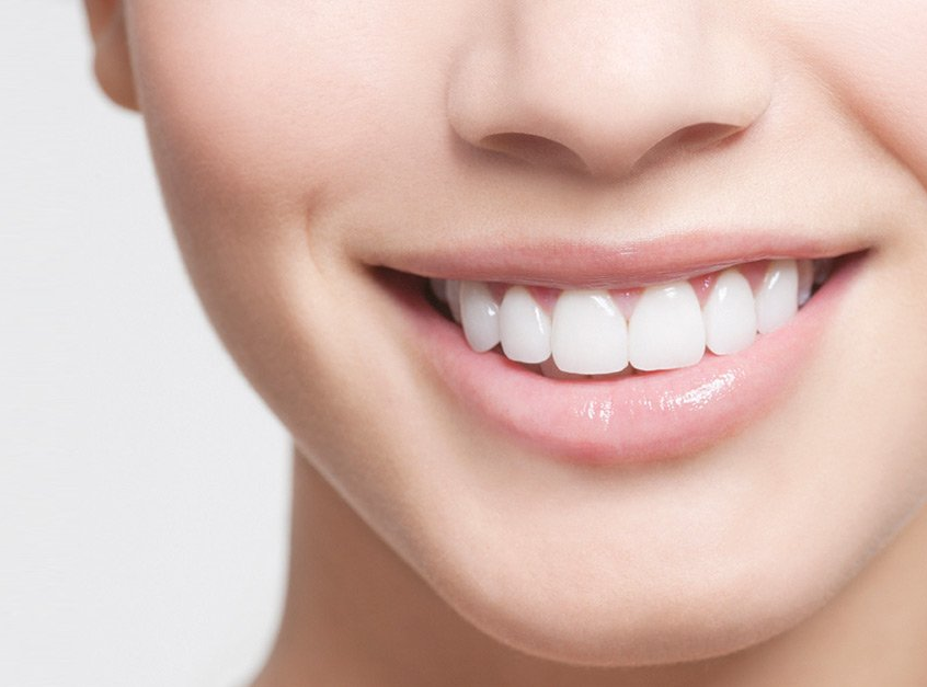 Transforming Smiles: 8 Most Common Cosmetic Dentistry Procedures in Fairfield